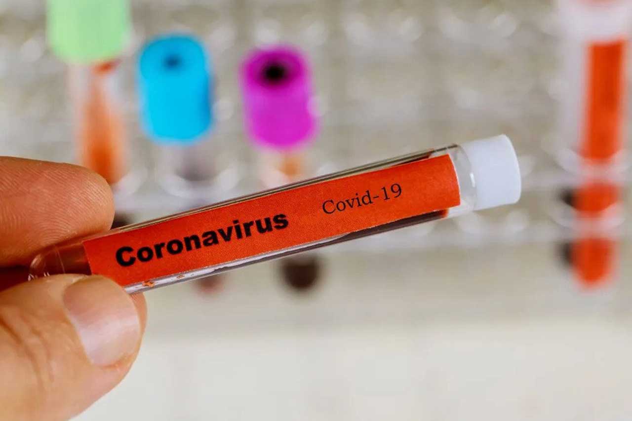 COVID-19 SARS-CoV-2 Coronavirus superspreaders blood test 2019-nCoV,SARS-CoV, MERS-CoV chinese infection blood test in Laboratory. COVID-19 cases concept. Illustration of first coronavirus death in India. Representation of coronavirus testing. Image credit: photovs / 123rf COVID-19 testing concept. Mutations illustration. antibodies concept. omicron