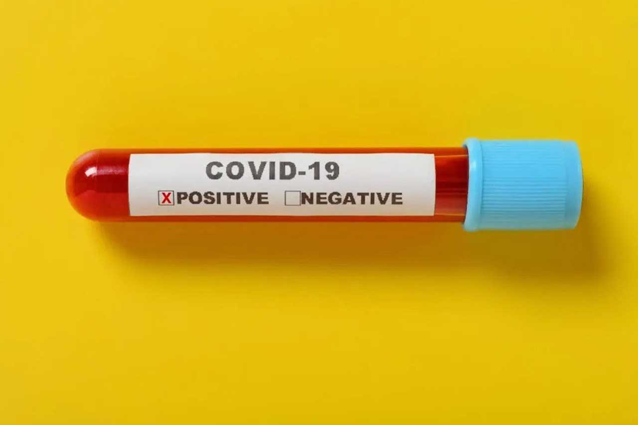 Confirmed cases of COVID-19 concept. a covid-19 blood test tube with result of positive on yellow background the X has clipping path and can be removed. COVID-19 testing concept. Antibody tests concept. Image credit: 罗 宏志 / 123rf. COVID-19 cases now number at one million: concept. Testing illustration. Symptomatic COVID-19 illustration. Cases of COVID-19 in India concept. COVID-19 clusters concept.. new covid-19 variant mutant strain long covid. COVID-19 cases concept. Even after recovery from COVID-19, long-COVID symptoms may persist. Image credit: 罗 宏志 / 123rf. B.1.617 concept. black fungus. Delta plus variant concern. Delta variant concept. Excess mortality illustration. Fresh COVID-19 cases illustration.