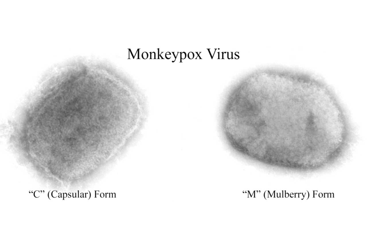 monkeypox