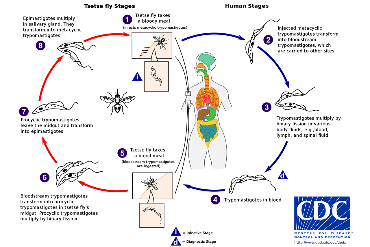 trypanosomiasis, sleeping sickness